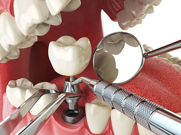Best Weekend Emergency Dentist in Chatham, VA